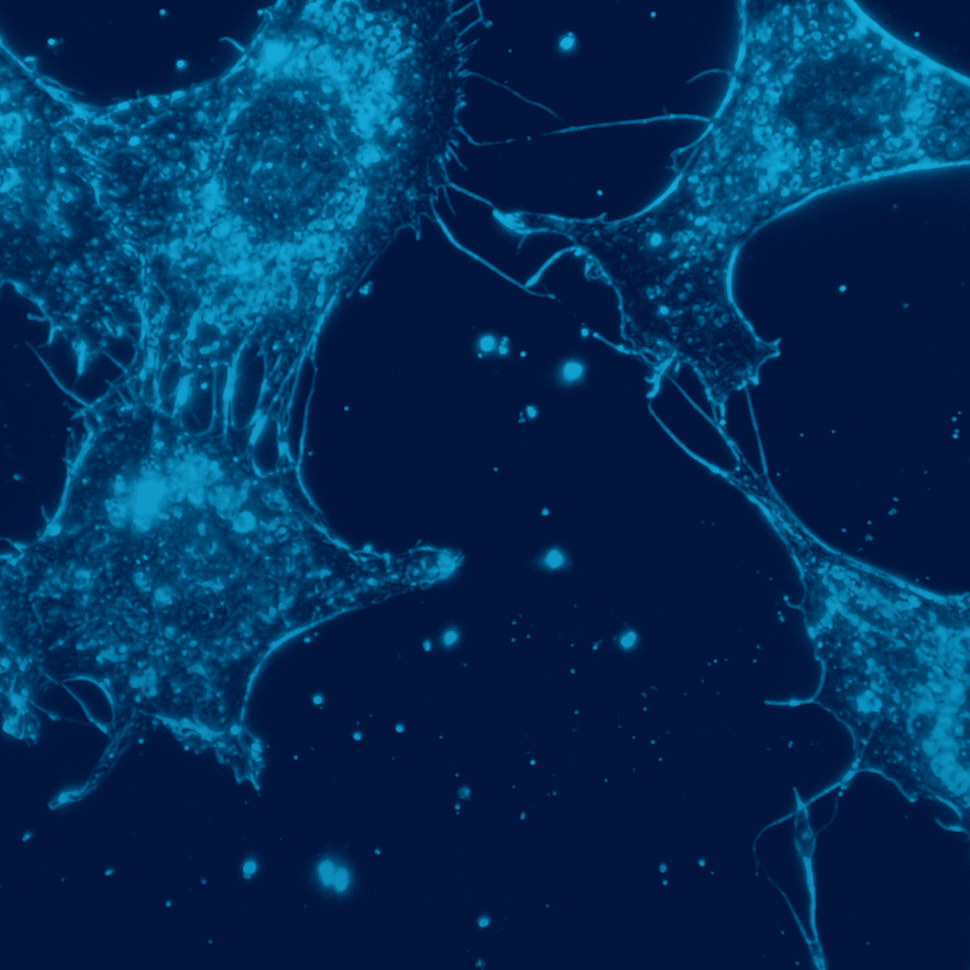 Microscopic view of glowing blue cell structures with branching, web-like extensions on a dark background.