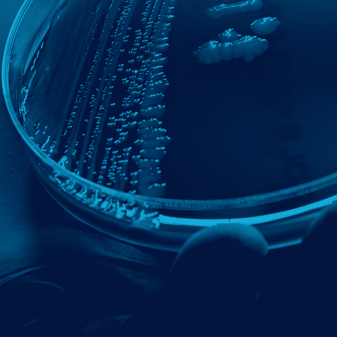 Petri dish with streaked bacterial colonies growing on agar under blue lighting